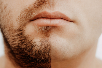 Beards vs No Beards
